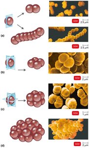 Cocci arrangements: diplococci, streptococci, tetrads, sarcinae, staphylococci