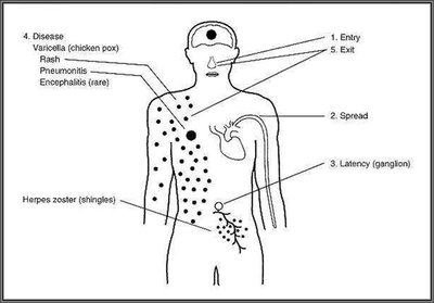 Diagram of VZV pathogenesis and latency