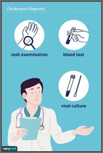 Chickenpox diagnosis methods