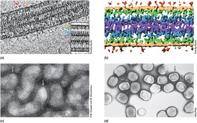 Electron micrographs of viral structures