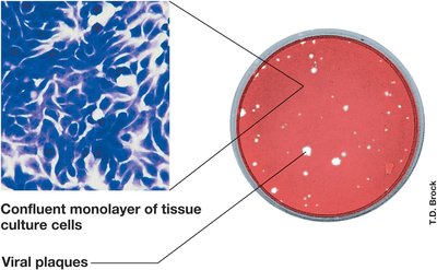Plaque assay for virus quantification