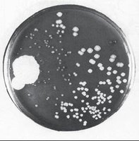 Penicillium mold inhibiting bacterial growth on agar plate