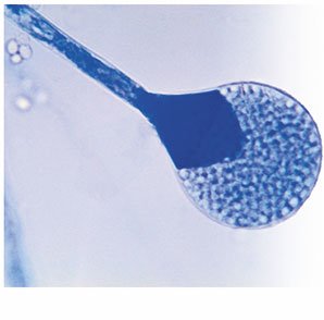 Sporangiospores from Absidia