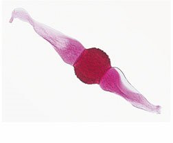Zygospores from Rhizopus