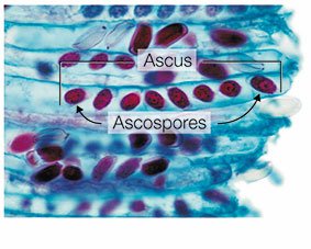 Ascospores from cup fungus