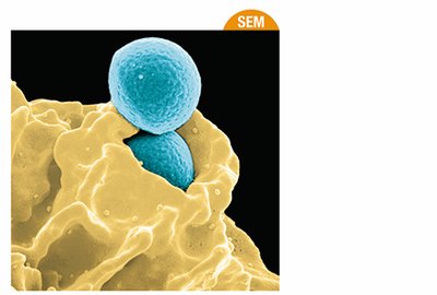 A human neutrophil engulfing Staphylococcus aureus bacteria (phagocytosis)