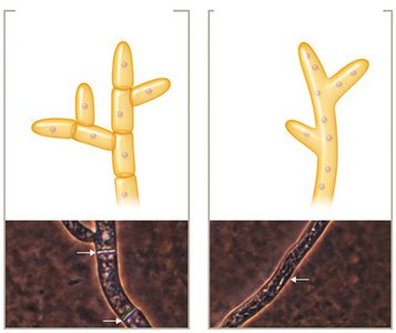 Septate and aseptate hyphae