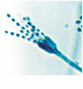 Conidiospores from Penicillium