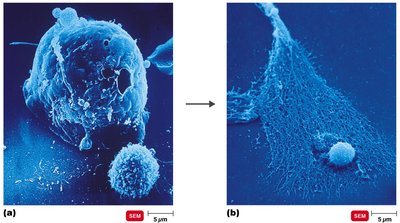 CTL attacking and lysing a cancer cell