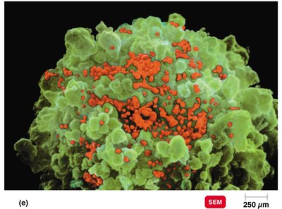 CD4+ T cell with HIV particles