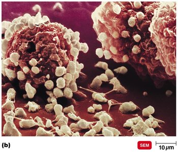 SEM of degranulated mast cell after antigen exposure