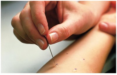 A skin test to identify allergens