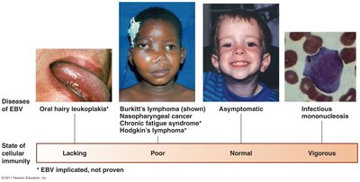 Diseases associated with Epstein-Barr virus