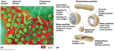 Three types of viral particles produced by hepatitis B virus