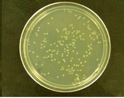 Petri dish with colonies for viable count