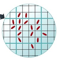 Direct counting of bacteria on grid
