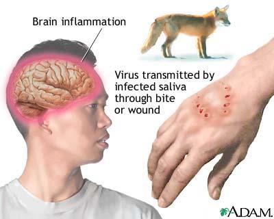 Rabies virus transmission and brain inflammation