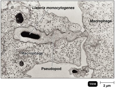 TEM image of Listeria monocytogenes inside macrophage