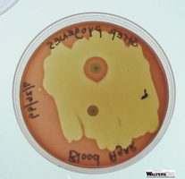 Blood agar plate with bacitracin and optochin disks