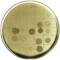 Phage typing of Salmonella enterica