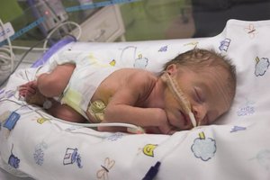 Premature infant in hospital