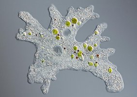 Amoeba with lobe-shaped pseudopodia