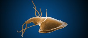 Giardia with multiple flagella
