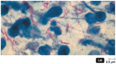 Mycobacterium tuberculosis, acid-fast cell wall