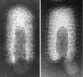Electron micrograph of helical viruses