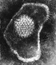 Enveloped virus with visible capsid and envelope