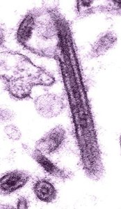 Electron micrograph of a helical virus