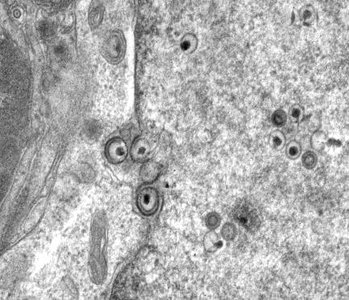 Electron micrograph of viral assembly and budding