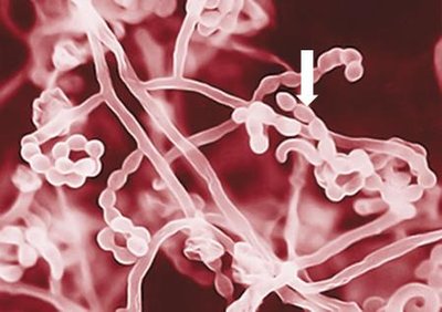 Streptomyces spores on hyphae
