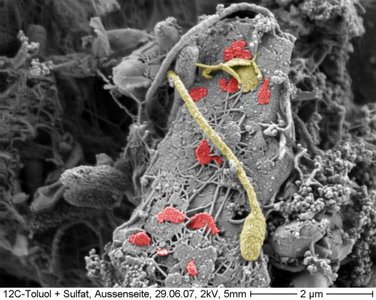 Budding bacteria in soil