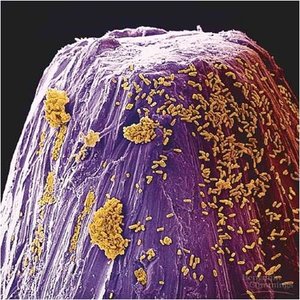 Bacterial cell size comparison