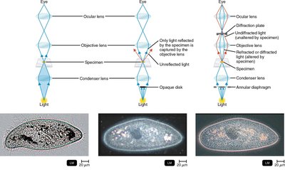 Differential Interference Contrast (DIC) microscopy image