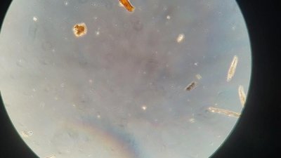 Brightfield microscopy image