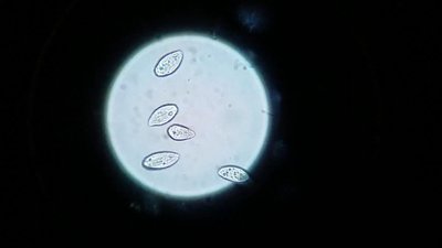 Darkfield microscopy image
