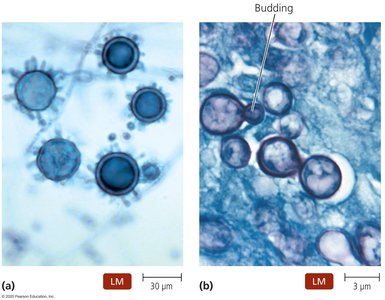 Characteristics of Histoplasma capsulatum