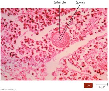 Spherules of Coccidioides immitis