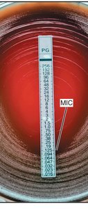 E-Test for minimum inhibitory concentration (MIC)