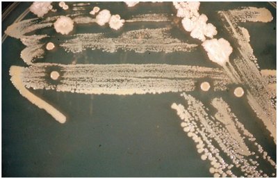 Laboratory observation of antibiosis