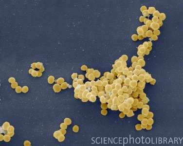 Electron micrograph of Staphylococcus aureus clusters