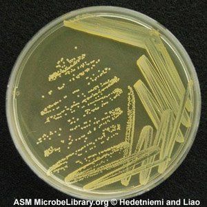 Staphylococcus aureus colonies on agar plate