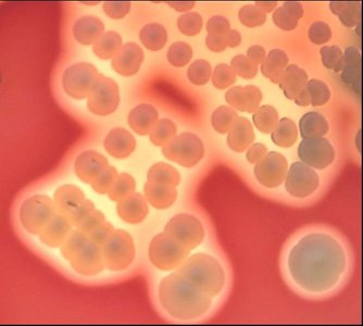 Staphylococcus aureus on blood agar showing hemolysis