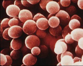 Staphylococcus aureus biofilm formation