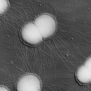 Electron micrograph of Neisseria gonorrhoeae diplococci