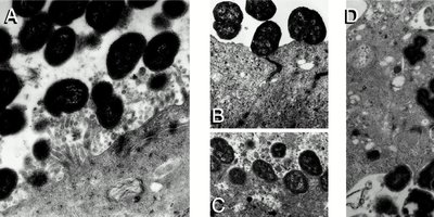 Electron micrographs of Neisseria gonorrhoeae infection stages