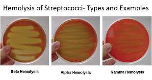 Hemolysis of Streptococci: Beta, Alpha, Gamma