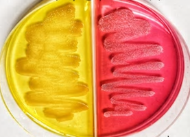 EMB Agar plate: metallic sheen and color changes